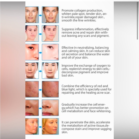 LED 7 Color Portable Skincare Facial Beauty Mask USB rechargeable NIB - Picture 13 of 15